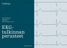 EKG viivain käyttö: Tehokkaat vinkit ja sovellukset arjessa