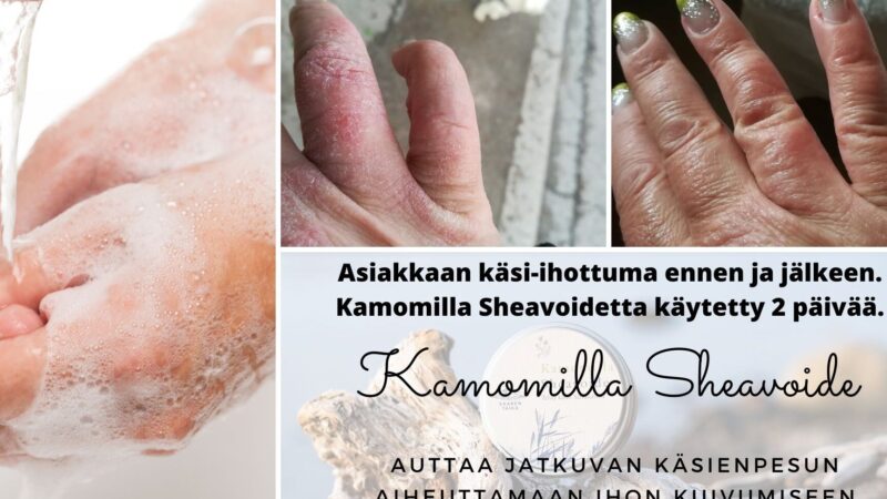 Kamomilla käyttö: Tehokkaat vinkit ja sovellukset jokapäiväisessä elämässä