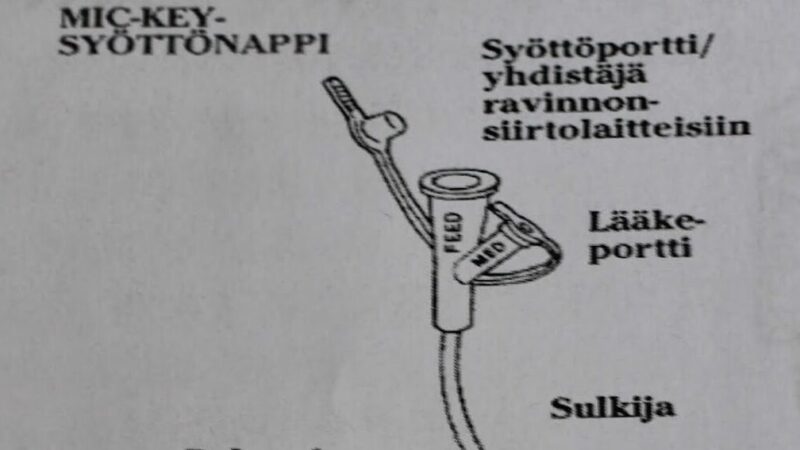 Peg Nappi Käyttö: Tehosta Tuotantoasi Innovatiivisilla Ratkaisuilla